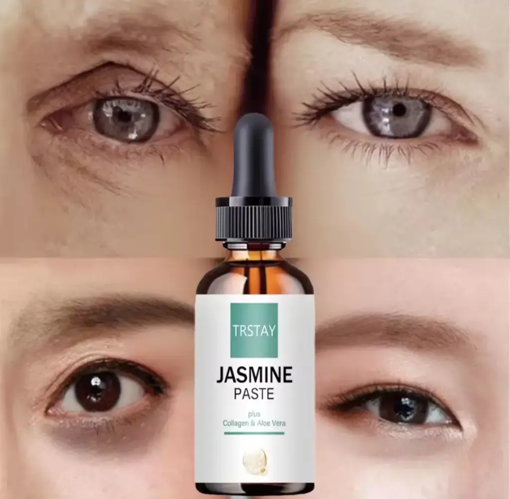 كريم تحت العيون 